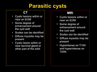 Parasitic cysts  CT Cystic lesions within or near an EOM Some degree of enhancement around the cyst wall Scolex can be identified Diffuse myositis may be present Cystic lesion within or near lacrimal gland or other part of the orbit MRI Cystic lesions within or near an EOM Some degree of enhancement around the cyst wall  Scolex can be identified Diffuse myositis may be present Hypointense on T1WI and hyperintense on T2WI. 