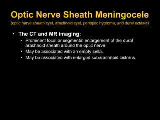 Optic Nerve Sheath Meningocele The CT and MR imaging; Prominent focal or segmental enlargement of the dural arachnoid sheath around the optic nerve  May be associated with an empty sella. May be associated with enlarged subarachnoid cisterns (optic nerve sheath cyst, arachnoid cyst, perioptic hygroma, and dural ectasia) 