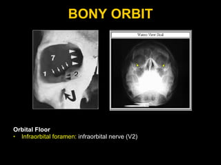 BONY ORBIT Orbital Floor Infraorbital foramen:   infraorbital nerve (V2) 