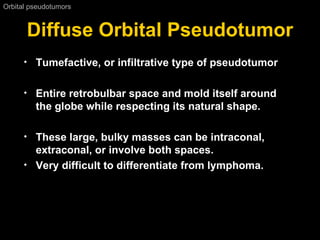 Diffuse Orbital Pseudotumor Orbital pseudotumors  Tumefactive, or infiltrative type of pseudotumor Entire retrobulbar space and mold itself around the globe while respecting its natural shape.  These large, bulky masses can be intraconal, extraconal, or involve both spaces.  Very difficult to differentiate from lymphoma.  