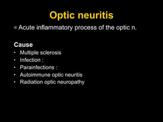 Optic neuritis =  Acute inflammatory process of the optic n. Cause Multiple sclerosis Infection :  Parainfections  :  Autoimmune optic neuritis Radiation optic neuropathy   