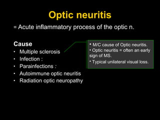 Optic neuritis =  Acute inflammatory process of the optic n. Cause Multiple sclerosis Infection :  Parainfections  :  Autoimmune optic neuritis Radiation optic neuropathy   M/C cause of Optic neuritis.  Optic neuritis = often an early sign of MS. Typical unilateral visual loss.   