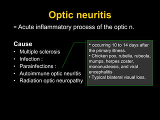 Optic neuritis =  Acute inflammatory process of the optic n. Cause Multiple sclerosis Infection :  Parainfections   :  Autoimmune optic neuritis Radiation optic neuropathy   occurring 10 to 14 days after the primary illness. Chicken pox, rubella, rubeola, mumps, herpes zoster, mononucleosis, and viral encephalitis  Typical bilateral visual loss,  
