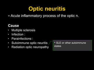 Optic neuritis =  Acute inflammatory process of the optic n. Cause Multiple sclerosis Infection :  Parainfections   :  Sutoimmune optic neuritis Radiation optic neuropathy   SLE or other autoimmune states  