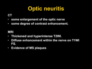 Optic neuritis CT some enlargement of the optic nerve some degree of contrast enhancement.  MRI Thickened and hyperintense T2WI. Diffuse enhancement within the nerve on T1WI FS. Evidence of MS plaques 