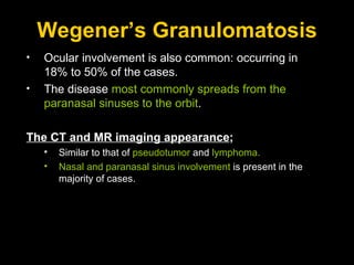 Wegener’s Granulomatosis Ocular involvement is also common: occurring in 18% to 50% of the cases. The disease  most commonly spreads from the paranasal sinuses to the orbit . The CT and MR imaging appearance ; Similar to that of  pseudotumor  and  lymphoma. Nasal and paranasal sinus involvement  is present in the majority of cases.  