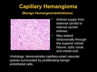 Capillary Hemangioma (Benign Hemangioendothelioma)   Arterial supply from external carotid or internal carotid arteries. May extend intracranially through the superior orbital fissure, optic canal, and orbital roof.  Histology: demonstrates capillary-sized vascular spaces surrounded by proliferating benign endothelial cells. 