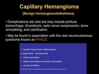 Capillary Hemangioma (Benign Hemangioendothelioma)   Complications are rare but may include profuse  hemorrhage ,  thrombosis ,  optic nerve compression ,  bone remodeling , and  calcification .  May be found in association with the rare neurocutaneous syndrome known as  PHACE P osterior fossa brain malformations Large facial  H emangiomas A rterial anomalies C ardiac anomalies and aortic Coarctation E ye abnormalities ( colobomas, optic nerve hypoplasia, increased retinal vascularity, and glaucoma) 