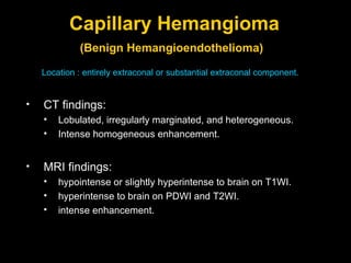 Capillary Hemangioma (Benign Hemangioendothelioma)   Location : entirely extraconal or substantial extraconal component.  CT findings: Lobulated, irregularly marginated, and heterogeneous. Intense homogeneous enhancement. MRI findings: hypointense or slightly hyperintense to brain on T1WI. hyperintense to brain on PDWI and T2WI. intense enhancement. 