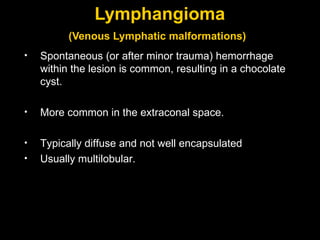 Lymphangioma (Venous Lymphatic malformations)   Spontaneous (or after minor trauma) hemorrhage within the lesion is common, resulting in a chocolate cyst. More common in the extraconal space. Typically diffuse and not well encapsulated Usually multilobular. 