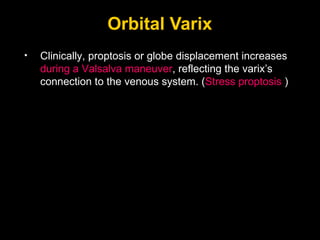 Orbital Varix Clinically, proptosis or globe displacement increases  during a Valsalva maneuver , reflecting the varix’s connection to the venous system. ( Stress proptosis  ) 