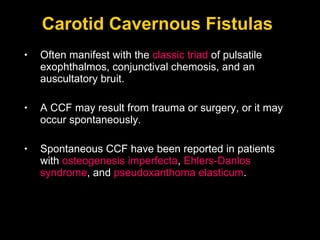 Carotid Cavernous Fistulas  Often manifest with the  classic triad  of pulsatile exophthalmos, conjunctival chemosis, and an auscultatory bruit.  A CCF may result from trauma or surgery, or it may occur spontaneously.  Spontaneous CCF have been reported in patients with  osteogenesis imperfecta ,  Ehlers-Danlos syndrome , and  pseudoxanthoma elasticum . 