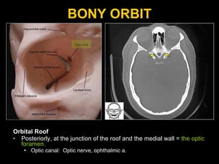 BONY ORBIT Orbital Roof Posteriorly, at the junction of the roof and the medial wall =  the optic foramen.  Optic canal:  Optic nerve, ophthalmic a. 