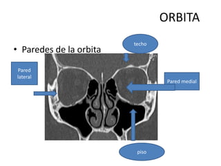 Orbita anatomia fracturas tratamiento qx | PPTX