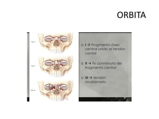 Orbita anatomia fracturas tratamiento qx | PPTX
