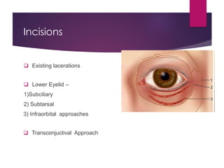 Subciliary Approach Incision Orbital Fracture & Management | PDF