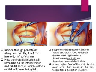 Orbital Fracture & Management | PDF