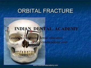 ORBITAL FRACTURE
INDIAN DENTAL ACADEMY
Leader in continuing dental education
www.indiandentalacademy.com

www.indiandentalacademy.com

 