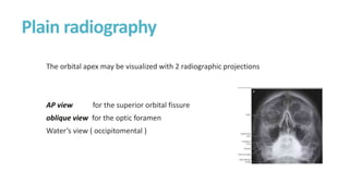 Orbital Apex conditions ophthalmology.pptx