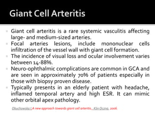  Giant cell arteritis is a rare systemic vasculitis affecting
large- and medium-sized arteries.
 Focal arteries lesions, include mononuclear cells
infiltration of the vessel wall with giant cell formation.
 The incidence of visual loss and ocular involvement varies
between 14-88%.
 Neuro-ophthalmic complications are common in GCA and
are seen in approximately 70% of patients especially in
those with biopsy proven disease.
 Typically presents in an elderly patient with headache,
inflamed temporal artery and high ESR. It can mimic
other orbital apex pathology.
Obuchowska I,A new approach towards giant cell arteritis., Klin Oczna. 2006.
 