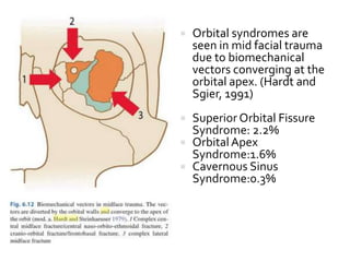  Orbital syndromes are
seen in mid facial trauma
due to biomechanical
vectors converging at the
orbital apex. (Hardt and
Sgier, 1991)
 Superior Orbital Fissure
Syndrome: 2.2%
 OrbitalApex
Syndrome:1.6%
 Cavernous Sinus
Syndrome:0.3%
 