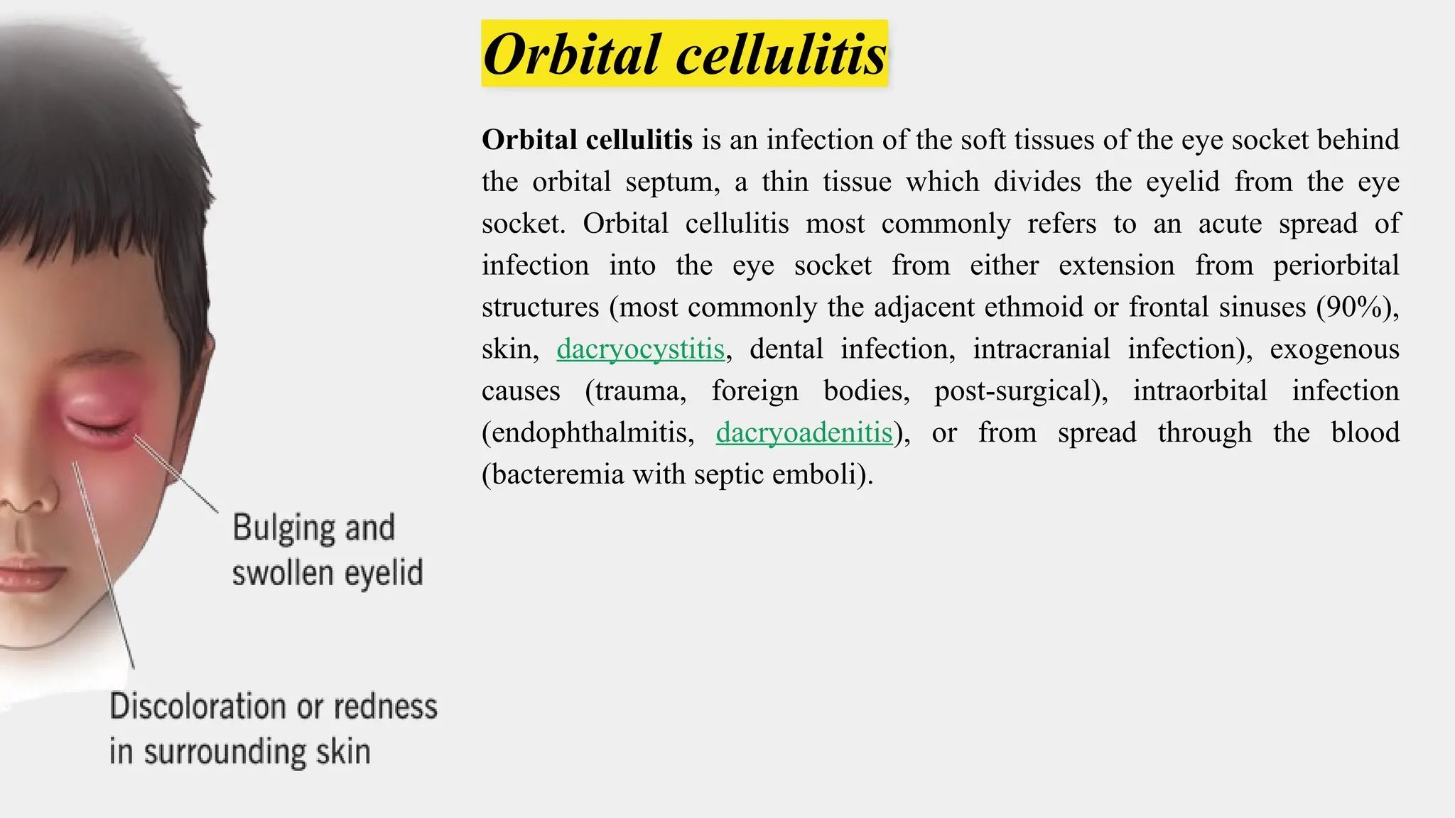 A Case Study on Orbital cellulitis .pptx
