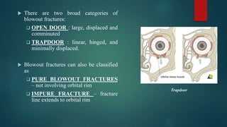 Orbital fracture | PPTX