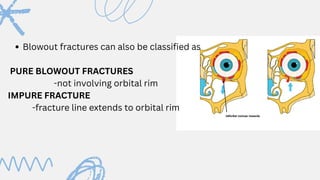 Orbital fracture, anatomy , surgical aproch | PDF