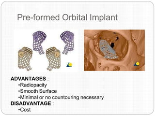 Pre-formed Orbital Implant
ADVANTAGES :
•Radiopacity
•Smooth Surface
•Minimal or no countouring necessary
DISADVANTAGE :
•Cost
 