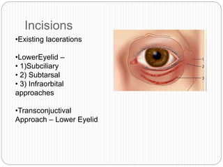 Incisions
•Existing lacerations
•LowerEyelid –
• 1)Subciliary
• 2) Subtarsal
• 3) Infraorbital
approaches
•Transconjuctival
Approach – Lower Eyelid
 