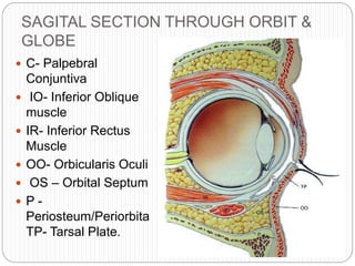 SAGITAL SECTION THROUGH ORBIT &
GLOBE
 C- Palpebral
Conjuntiva
 IO- Inferior Oblique
muscle
 IR- Inferior Rectus
Muscle
 OO- Orbicularis Oculi
 OS – Orbital Septum
 P -
Periosteum/Periorbita
TP- Tarsal Plate.
 