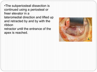 •The subperiosteal dissection is
continued using a periosteal or
freer elevator in a
lateromedial direction and lifted up
and retracted by and by with the
ribbon
retractor until the entrance of the
apex is reached.
 
