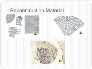 Reconstruction Material
 