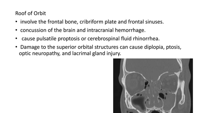 ORBITAL FRACTURES.pptx