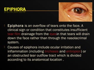 Orbital fractures ih | PPT