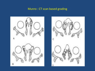 Munro : CT scan based grading
 