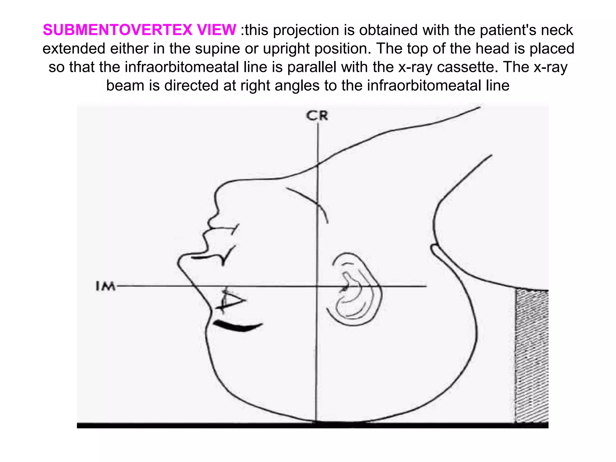 Gh View Positioning Orbital imaging (X-RAY,CT SCAN,AND MRI) | PPT