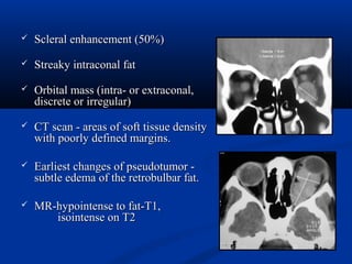  Scleral enhancement (50%)Scleral enhancement (50%)
 Streaky intraconal fatStreaky intraconal fat
 Orbital mass (intra- or extraconal,Orbital mass (intra- or extraconal,
discrete or irregular)discrete or irregular)
 CT scan - areas of soft tissue densityCT scan - areas of soft tissue density
with poorly defined margins.with poorly defined margins.
 Earliest changes of pseudotumor -Earliest changes of pseudotumor -
subtle edema of the retrobulbar fat.subtle edema of the retrobulbar fat.
 MR-hypointense to fat-T1,MR-hypointense to fat-T1,
isointense on T2isointense on T2
 