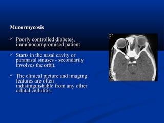 MucormycosisMucormycosis
 Poorly controlled diabetes,Poorly controlled diabetes,
immunocompromised patientimmunocompromised patient
 Starts in the nasal cavity orStarts in the nasal cavity or
paranasal sinuses - secondarilyparanasal sinuses - secondarily
involves the orbit.involves the orbit.
 The clinical picture and imagingThe clinical picture and imaging
features are oftenfeatures are often
indistinguishable from any otherindistinguishable from any other
orbital cellulitis.orbital cellulitis.
 