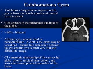 Colobomatous CystsColobomatous Cysts
 Coloboma - congenital or acquired notch,Coloboma - congenital or acquired notch,
gap or fissure in which a portion of normalgap or fissure in which a portion of normal
tissue is absenttissue is absent
 Cleft appears in the inferonasal quadrant ofCleft appears in the inferonasal quadrant of
the globe.the globe.
 > 60% - bilateral> 60% - bilateral
 Affected eye - normal sized orAffected eye - normal sized or
microphthalmic . A cleft in the globe may bemicrophthalmic . A cleft in the globe may be
visualized . Tunnel-like connection betweenvisualized . Tunnel-like connection between
the eye and the cyst is often very thin andthe eye and the cyst is often very thin and
difficult to image.difficult to image.
 CT - anatomic relationship of the cyst to theCT - anatomic relationship of the cyst to the
globe prior to surgical intervention , anyglobe prior to surgical intervention , any
associated developmental anomalies of theassociated developmental anomalies of the
brain.brain.
 