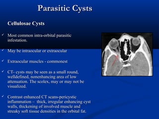 Parasitic CystsParasitic Cysts
Cellulosae CystsCellulosae Cysts
 Most common intra-orbital parasiticMost common intra-orbital parasitic
infestation.infestation.
 May be intraocular or extraocularMay be intraocular or extraocular
 Extraocular muscles - commonestExtraocular muscles - commonest
 CT- cysts may be seen as a small round,CT- cysts may be seen as a small round,
welldefined, nonenhancing area of lowwelldefined, nonenhancing area of low
attenuation. The scolex, may or may not beattenuation. The scolex, may or may not be
visualized.visualized.
 Contrast enhanced CT scans-pericysticContrast enhanced CT scans-pericystic
inflammation – thick, irregular enhancing cystinflammation – thick, irregular enhancing cyst
walls, thickening of involved muscle andwalls, thickening of involved muscle and
streaky soft tissue densities in the orbital fat.streaky soft tissue densities in the orbital fat.
 