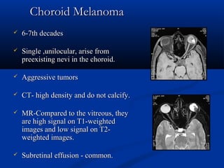 Choroid MelanomaChoroid Melanoma
 6-7th decades6-7th decades
 Single ,unilocular, arise fromSingle ,unilocular, arise from
preexisting nevi in the choroid.preexisting nevi in the choroid.
 Aggressive tumorsAggressive tumors
 CT- high density and do not calcify.CT- high density and do not calcify.
 MR-Compared to the vitreous, theyMR-Compared to the vitreous, they
are high signal on T1-weightedare high signal on T1-weighted
images and low signal on T2-images and low signal on T2-
weighted images.weighted images.
 Subretinal effusion - common.Subretinal effusion - common.
 