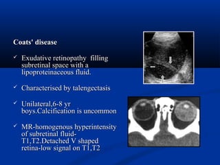 Coats' diseaseCoats' disease
 Exudative retinopathy fillingExudative retinopathy filling
subretinal space with asubretinal space with a
lipoproteinaceous fluid.lipoproteinaceous fluid.
 Characterised by talengectasisCharacterised by talengectasis
 Unilateral,6-8 yrUnilateral,6-8 yr
boys.Calcification is uncommonboys.Calcification is uncommon
 MR-homogenous hyperintensityMR-homogenous hyperintensity
of subretinal fluid-of subretinal fluid-
T1,T2.Detached V shapedT1,T2.Detached V shaped
retina-low signal on T1,T2retina-low signal on T1,T2
 