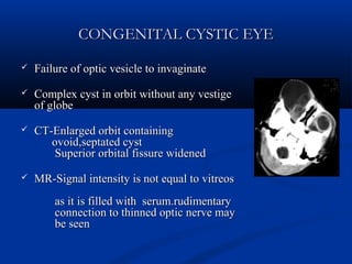 CONGENITAL CYSTIC EYECONGENITAL CYSTIC EYE
 Failure of optic vesicle to invaginateFailure of optic vesicle to invaginate
 Complex cyst in orbit without any vestigeComplex cyst in orbit without any vestige
of globeof globe
 CT-Enlarged orbit containingCT-Enlarged orbit containing
ovoid,septated cystovoid,septated cyst
Superior orbital fissure widenedSuperior orbital fissure widened
 MR-Signal intensity is not equal to vitreosMR-Signal intensity is not equal to vitreos
as it is filled with serum.rudimentaryas it is filled with serum.rudimentary
connection to thinned optic nerve mayconnection to thinned optic nerve may
be seenbe seen
 