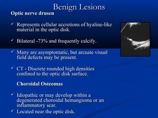 Benign LesionsBenign Lesions
Optic nerve drusenOptic nerve drusen
 Represents cellular accretions of hyaline-likeRepresents cellular accretions of hyaline-like
material in the optic disk.material in the optic disk.
 Bilateral -73% and frequently calcify.Bilateral -73% and frequently calcify.
 Many are asymptomatic, but arcuate visualMany are asymptomatic, but arcuate visual
field defects may be present.field defects may be present.
 CT - Discrete rounded high densitiesCT - Discrete rounded high densities
confined to the optic disk surface.confined to the optic disk surface.
Choroidal OsteomasChoroidal Osteomas
 Idiopathic or may develop within aIdiopathic or may develop within a
degenerated choroidal hemangioma or andegenerated choroidal hemangioma or an
inflammatory scar.inflammatory scar.
 Located near the optic disk.Located near the optic disk.
 