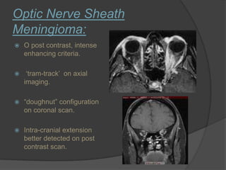 Optic Nerve Sheath
Meningioma:
 O post contrast, intense
enhancing criteria.
 „tram-track‟ on axial
imaging.
 “doughnut” configuration
on coronal scan.
 Intra-cranial extension
better detected on post
contrast scan.
 