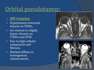 Orbital pseudotumor:
 MR imaging:
 Hypointense tonormal
muscle on TIWIs.
 Iso-intense to slighly
hyper-intense on
T2WIs and STIR.
 Due to high cellular
component and
fibrosis.
 Marked diffuse in-
homogenous
enhancement.
 