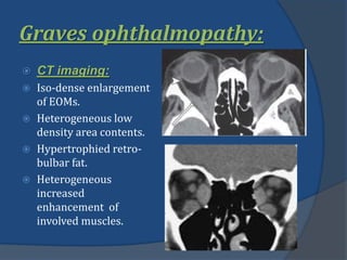 Graves ophthalmopathy:
 CT imaging:
 Iso-dense enlargement
of EOMs.
 Heterogeneous low
density area contents.
 Hypertrophied retro-
bulbar fat.
 Heterogeneous
increased
enhancement of
involved muscles.
 