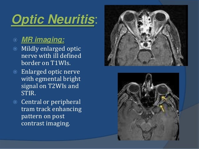 orbital-imaging-vi