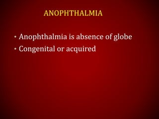 ANOPHTHALMIA
• Anophthalmia is absence of globe
• Congenital or acquired
 